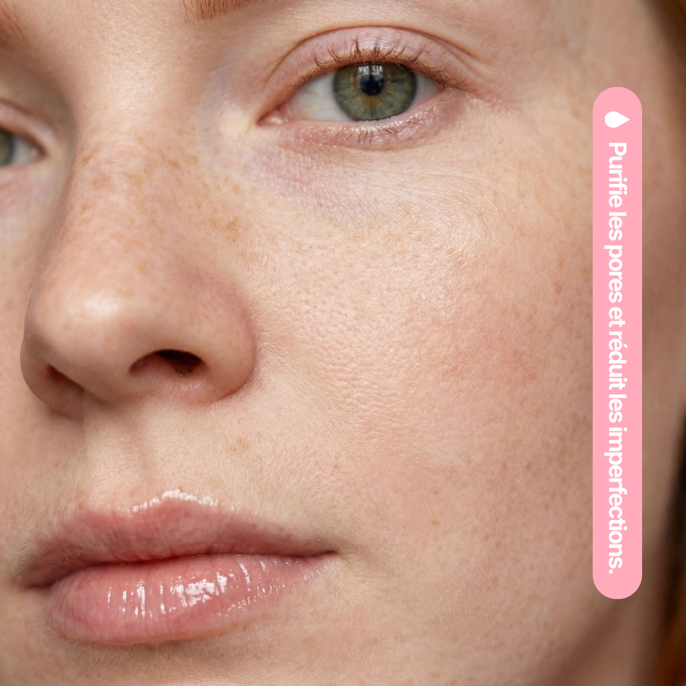 Nettoyant Anti-Acné